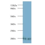 ADP-ribosylation factor 4 Polyclonal Antibody from Signalway Antibody (42173) - Antibodies.com