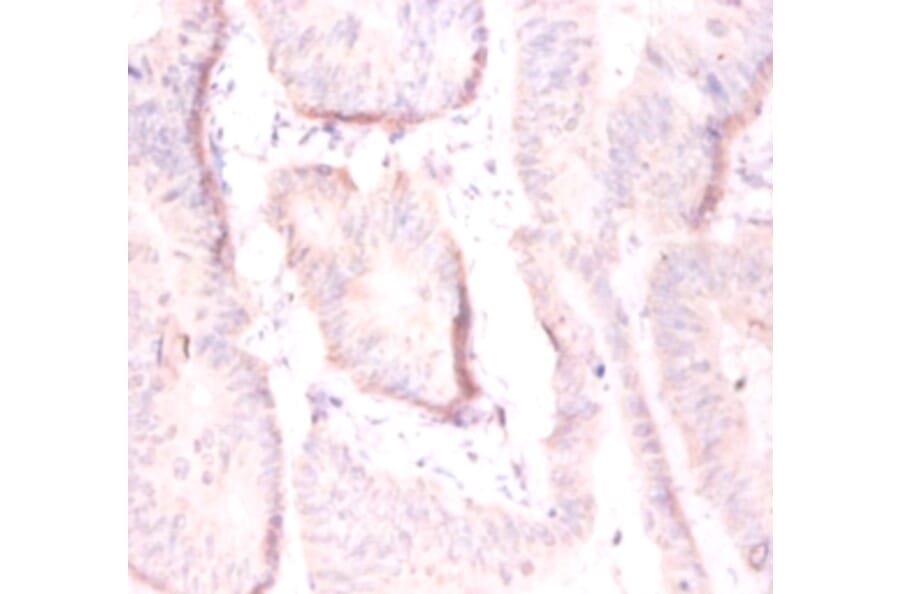 Immunohistochemistry - ADP-ribosylation factor 4 Polyclonal Antibody from Signalway Antibody - Antibodies.com