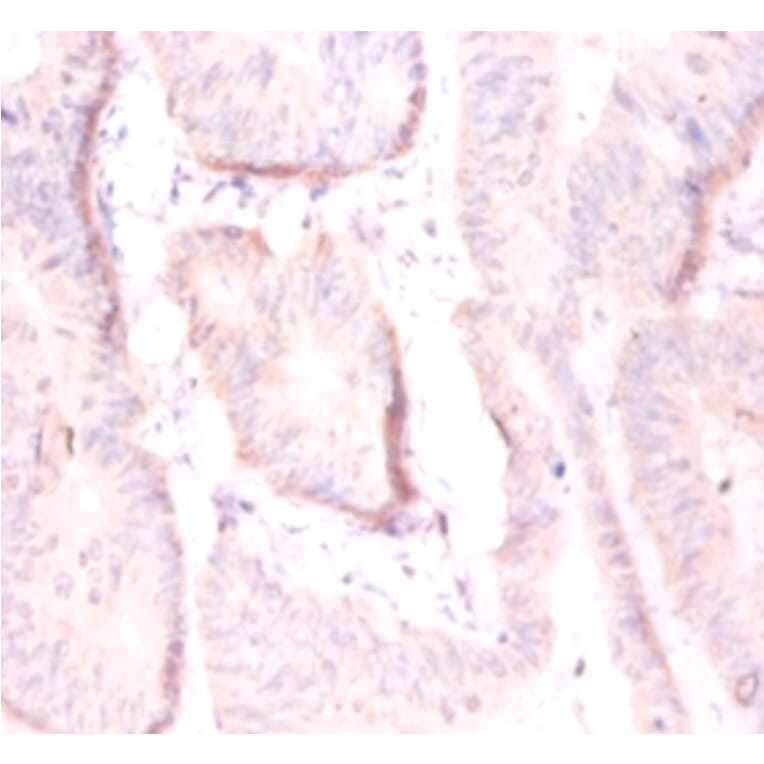 Immunohistochemistry - ADP-ribosylation factor 4 Polyclonal Antibody from Signalway Antibody - Antibodies.com
