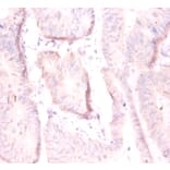 Immunohistochemistry - ADP-ribosylation factor 4 Polyclonal Antibody from Signalway Antibody - Antibodies.com
