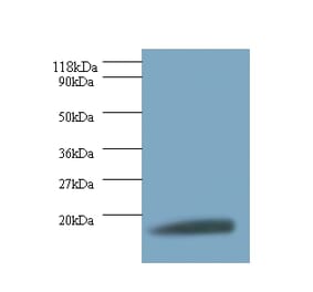 40S ribosomal protein S11 Polyclonal Antibody from Signalway Antibody (42299) - Antibodies.com