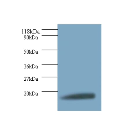 40S ribosomal protein S11 Polyclonal Antibody from Signalway Antibody (42299) - Antibodies.com
