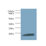 40S ribosomal protein S11 Polyclonal Antibody from Signalway Antibody (42299) - Antibodies.com