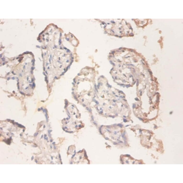 Immunohistochemistry - 40S ribosomal protein S11 Polyclonal Antibody from Signalway Antibody - Antibodies.com
