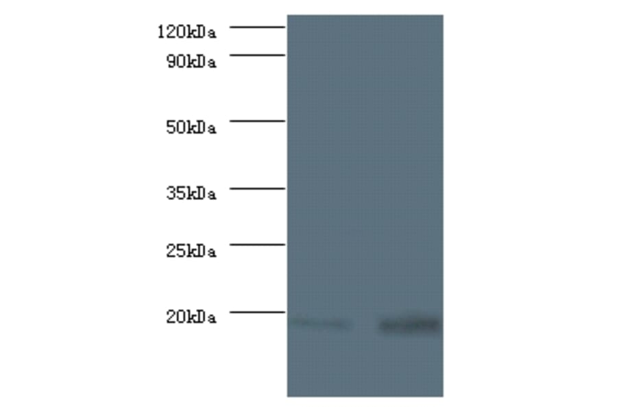 40S ribosomal protein S13 Polyclonal Antibody from Signalway Antibody (42356) - Antibodies.com