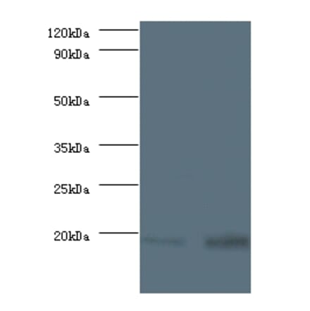 40S ribosomal protein S13 Polyclonal Antibody from Signalway Antibody (42356) - Antibodies.com