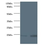 40S ribosomal protein S13 Polyclonal Antibody from Signalway Antibody (42356) - Antibodies.com