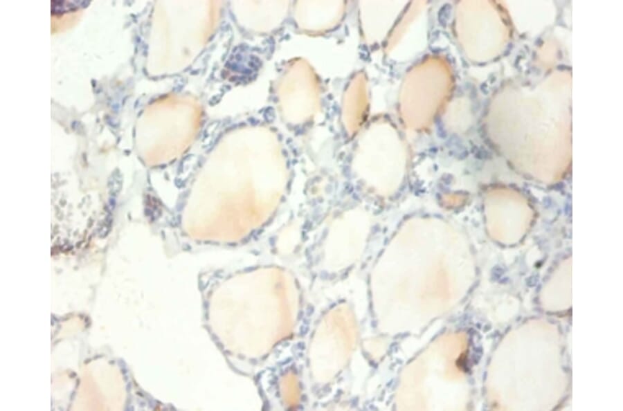 Immunohistochemistry - 40S ribosomal protein S13 Polyclonal Antibody from Signalway Antibody - Antibodies.com