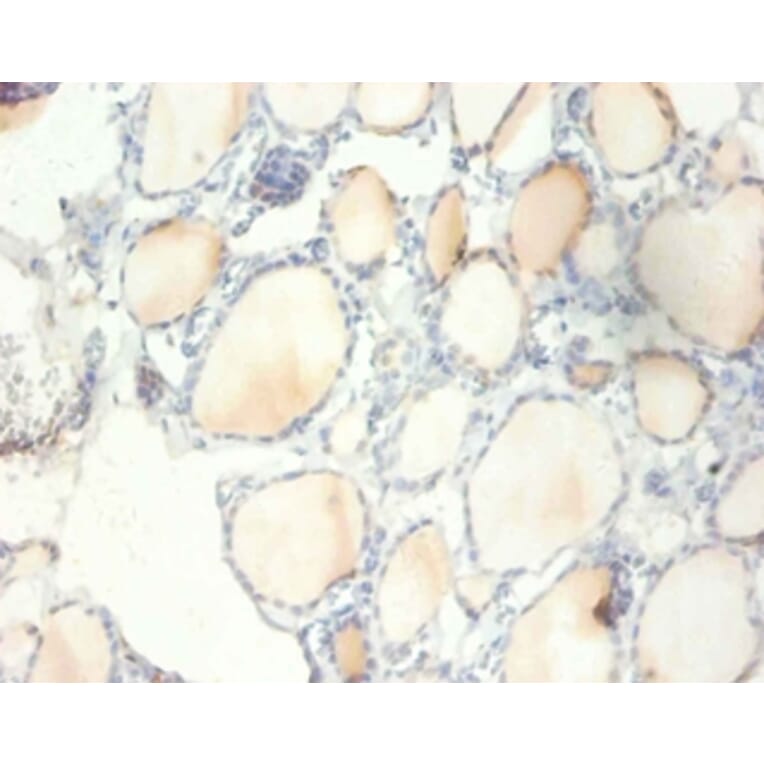 Immunohistochemistry - 40S ribosomal protein S13 Polyclonal Antibody from Signalway Antibody - Antibodies.com