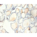 Immunohistochemistry - 40S ribosomal protein S13 Polyclonal Antibody from Signalway Antibody - Antibodies.com