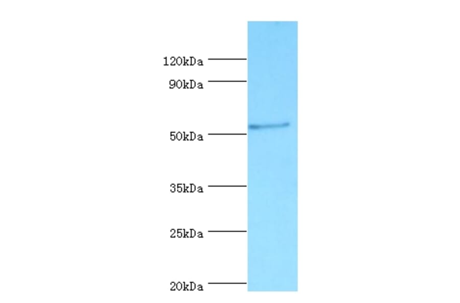 Vitamin D-binding protein Polyclonal Antibody from Signalway Antibody (42490) - Antibodies.com