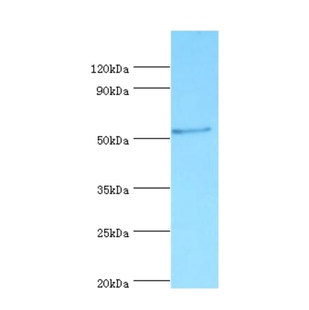 Vitamin D-binding protein Polyclonal Antibody from Signalway Antibody (42490) - Antibodies.com