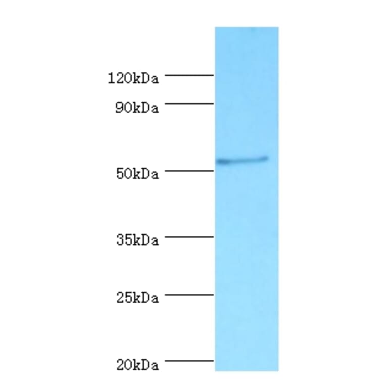 Vitamin D-binding protein Polyclonal Antibody from Signalway Antibody (42490) - Antibodies.com