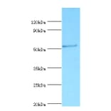 Vitamin D-binding protein Polyclonal Antibody from Signalway Antibody (42490) - Antibodies.com