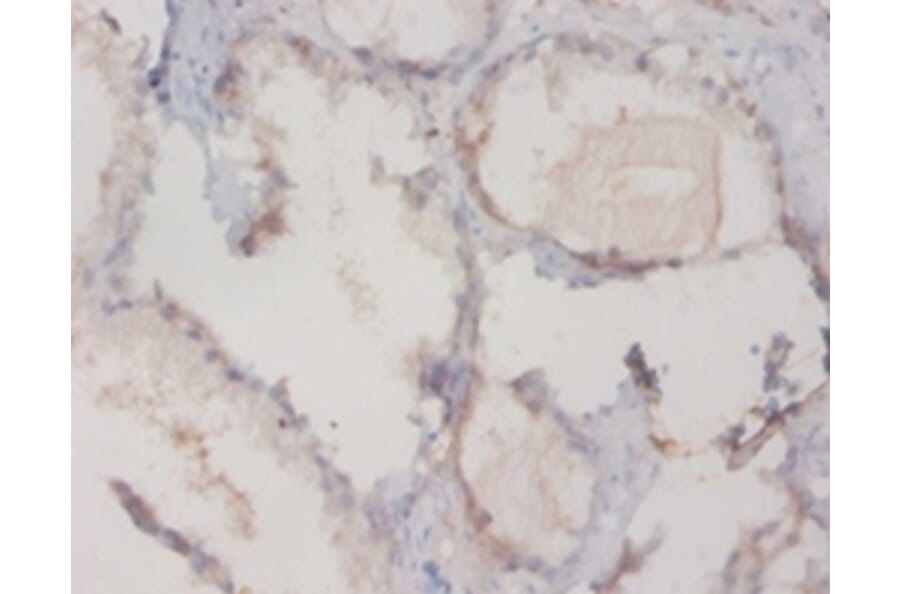 Immunohistochemistry - Vitamin D-binding protein Polyclonal Antibody from Signalway Antibody - Antibodies.com