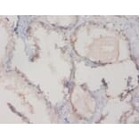 Immunohistochemistry - Vitamin D-binding protein Polyclonal Antibody from Signalway Antibody - Antibodies.com