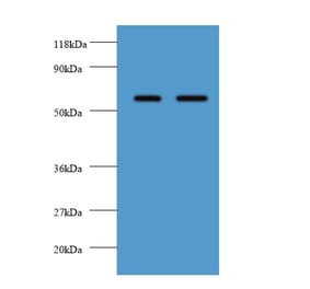 Plasma alpha-L-fucosidase Polyclonal Antibody from Signalway Antibody (42561) - Antibodies.com