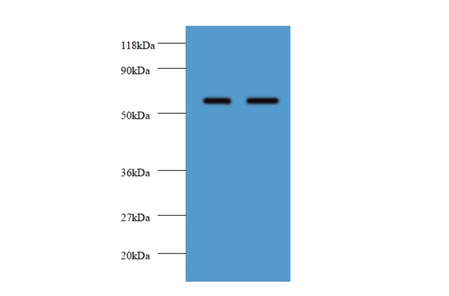 Plasma alpha-L-fucosidase Polyclonal Antibody from Signalway Antibody (42561) - Antibodies.com