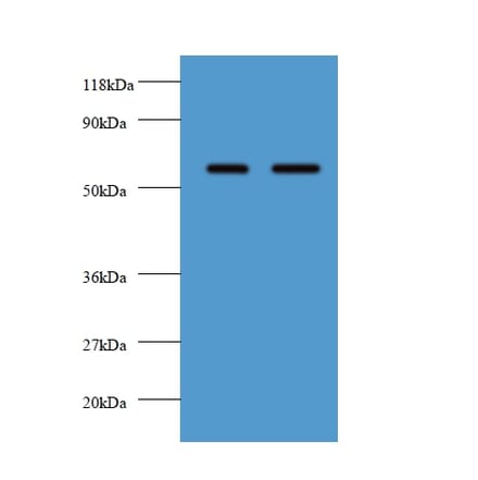 Plasma alpha-L-fucosidase Polyclonal Antibody from Signalway Antibody (42561) - Antibodies.com