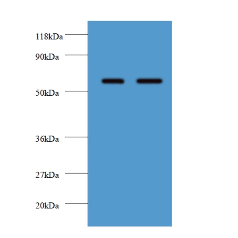 Plasma alpha-L-fucosidase Polyclonal Antibody from Signalway Antibody (42561) - Antibodies.com