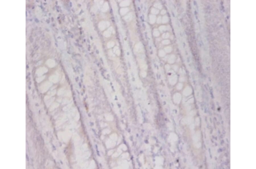Immunohistochemistry - Plasma alpha-L-fucosidase Polyclonal Antibody from Signalway Antibody - Antibodies.com
