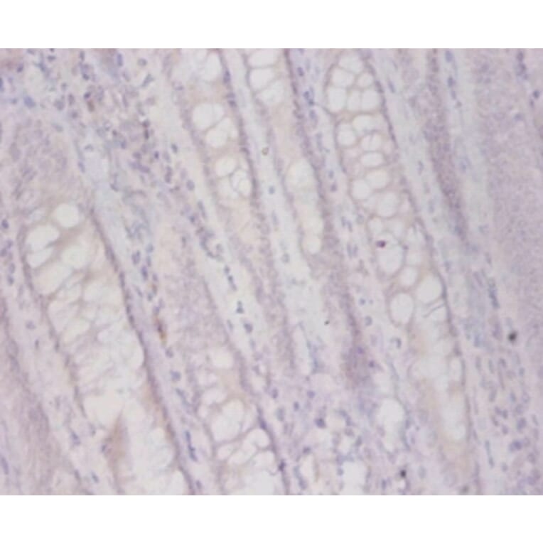 Immunohistochemistry - Plasma alpha-L-fucosidase Polyclonal Antibody from Signalway Antibody - Antibodies.com