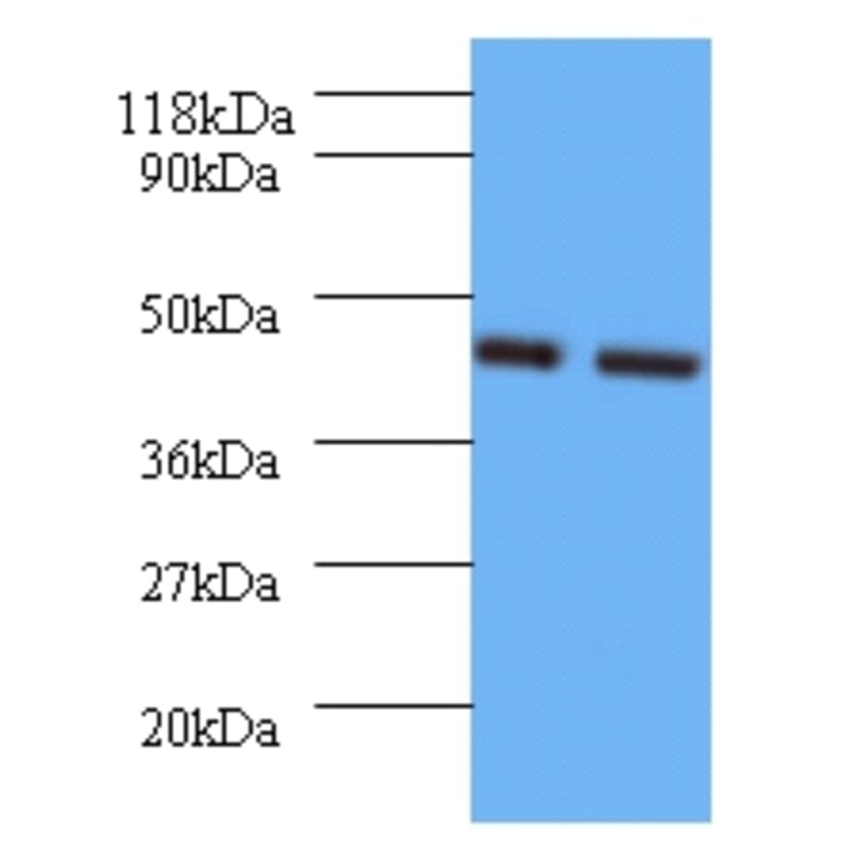 Vasopressin V1b receptor Polyclonal Antibody; from Signalway Antibody (42598) - Antibodies.com