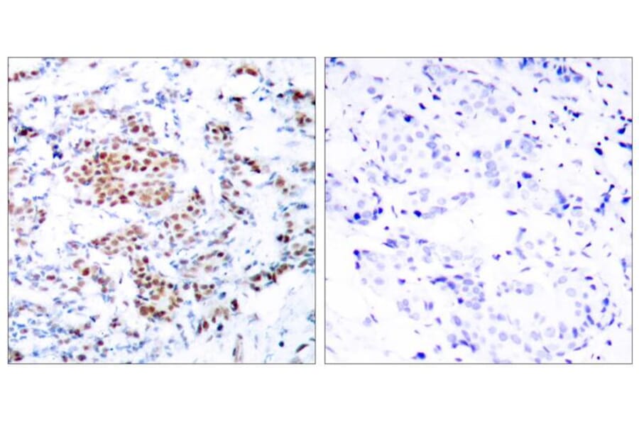 Immunohistochemistry - STAT5a (Ab-694) Antibody from Signalway Antibody (21048) - Antibodies.com