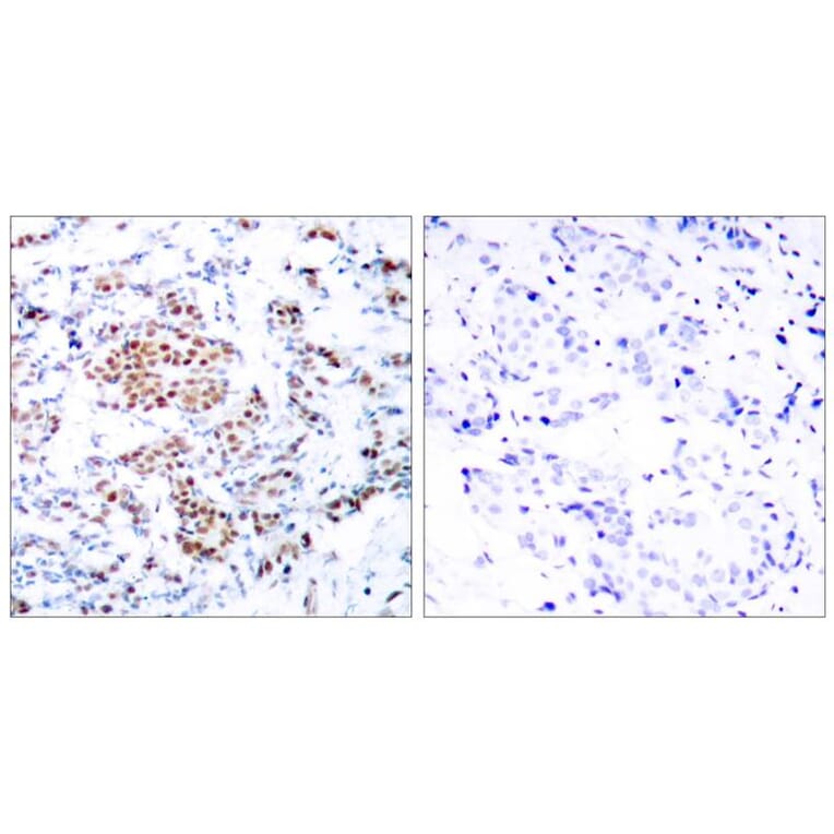 Immunohistochemistry - STAT5a (Ab-694) Antibody from Signalway Antibody (21048) - Antibodies.com