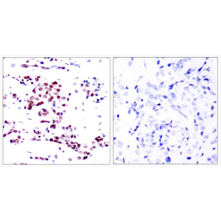 Immunohistochemistry - STAT5a (Ab-780) Antibody from Signalway Antibody (21049) - Antibodies.com