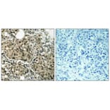 Immunohistochemistry - G3BP-1 (Ab-232) Antibody from Signalway Antibody (21102) - Antibodies.com