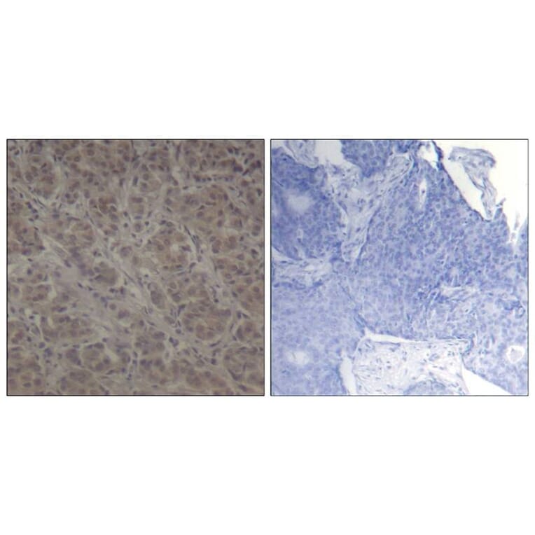 Immunohistochemistry - p90RSK (Ab-352) Antibody from Signalway Antibody (21136) - Antibodies.com