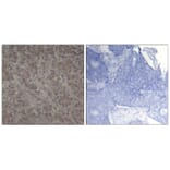 Immunohistochemistry - p90RSK (Ab-352) Antibody from Signalway Antibody (21136) - Antibodies.com