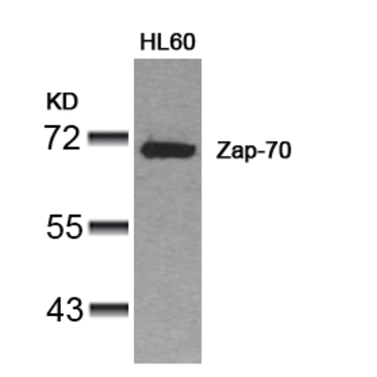 Western blot - Zap-70 (Ab-319) Antibody from Signalway Antibody (21173) - Antibodies.com