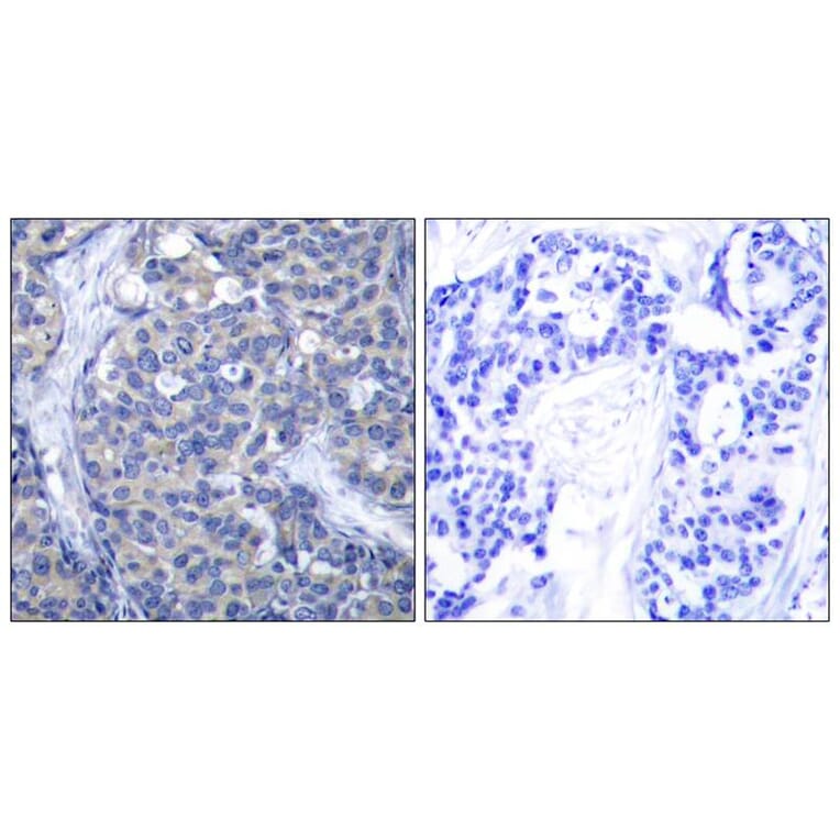 Immunohistochemistry - Zap-70 (Ab-319) Antibody from Signalway Antibody (21173) - Antibodies.com