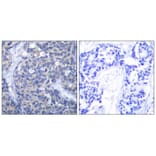 Immunohistochemistry - Zap-70 (Ab-319) Antibody from Signalway Antibody (21173) - Antibodies.com