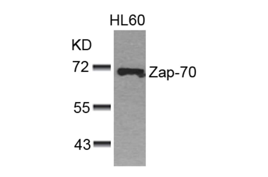 Western blot - Zap-70 (Ab-493) Antibody from Signalway Antibody (21174) - Antibodies.com