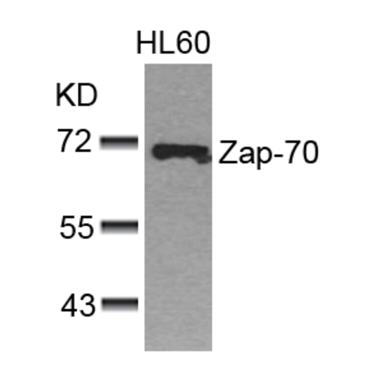 Western blot - Zap-70 (Ab-493) Antibody from Signalway Antibody (21174) - Antibodies.com