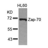 Western blot - Zap-70 (Ab-493) Antibody from Signalway Antibody (21174) - Antibodies.com