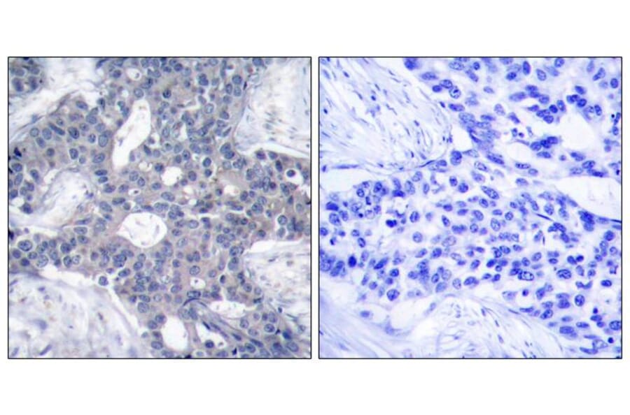 Immunohistochemistry - Zap-70 (Ab-493) Antibody from Signalway Antibody (21174) - Antibodies.com