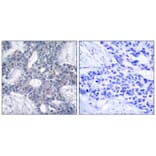 Immunohistochemistry - Zap-70 (Ab-493) Antibody from Signalway Antibody (21174) - Antibodies.com