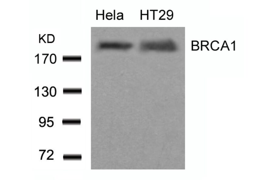 Western blot - BRCA1 (Ab-1423) Antibody from Signalway Antibody (21234) - Antibodies.com