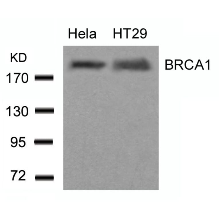Western blot - BRCA1 (Ab-1423) Antibody from Signalway Antibody (21234) - Antibodies.com