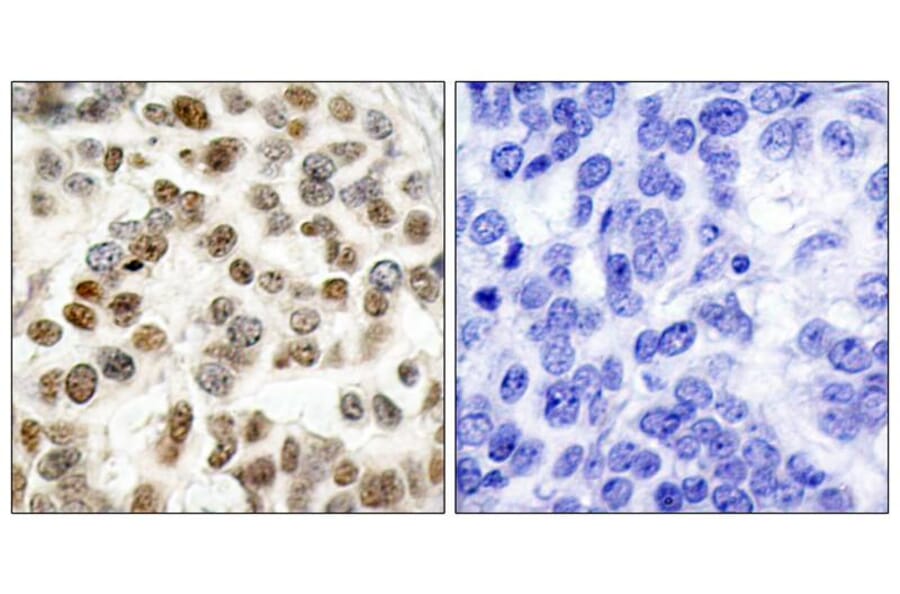 Immunohistochemistry - BRCA1 (Ab-1423) Antibody from Signalway Antibody (21234) - Antibodies.com