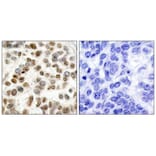 Immunohistochemistry - BRCA1 (Ab-1423) Antibody from Signalway Antibody (21234) - Antibodies.com