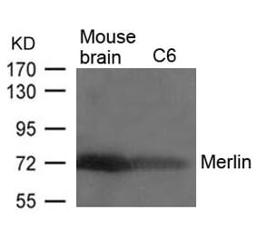 Western blot - Merlin (Ab-518) Antibody from Signalway Antibody (21258) - Antibodies.com