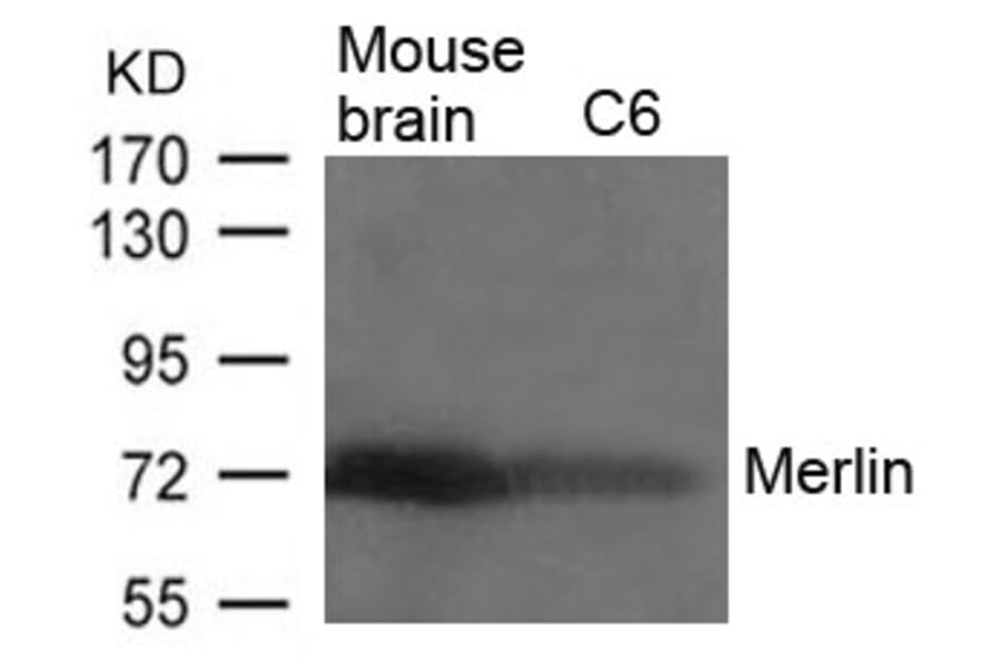 Western blot - Merlin (Ab-518) Antibody from Signalway Antibody (21258) - Antibodies.com