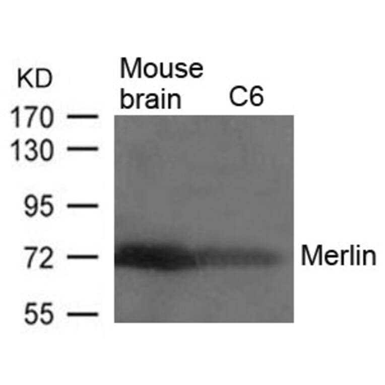 Western blot - Merlin (Ab-518) Antibody from Signalway Antibody (21258) - Antibodies.com