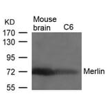 Western blot - Merlin (Ab-518) Antibody from Signalway Antibody (21258) - Antibodies.com