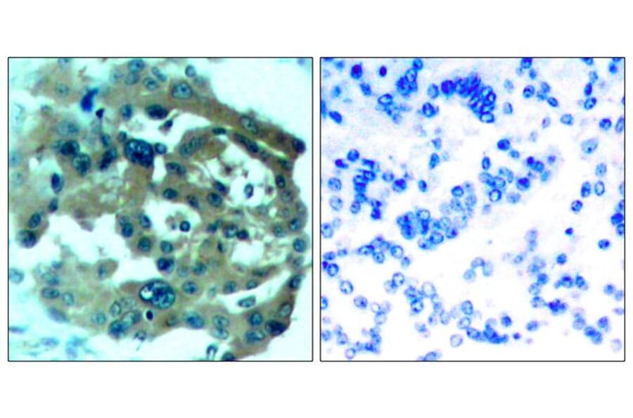 Immunohistochemistry - Merlin (Ab-518) Antibody from Signalway Antibody (21258) - Antibodies.com